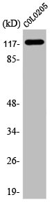 ADCY1 Antibody