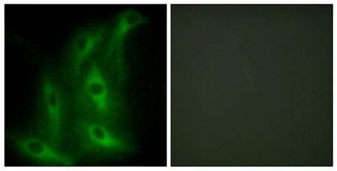 Collagen IV α6 Antibody