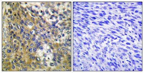 Collagen IV α6 Antibody