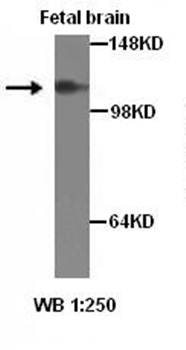 ADCY2 Rabbit Polyclonal Antibody