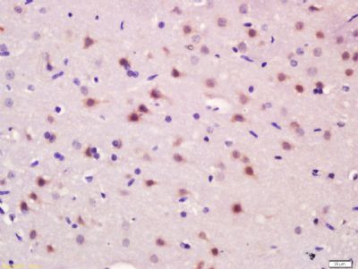 ADCY3 Rabbit Polyclonal Antibody