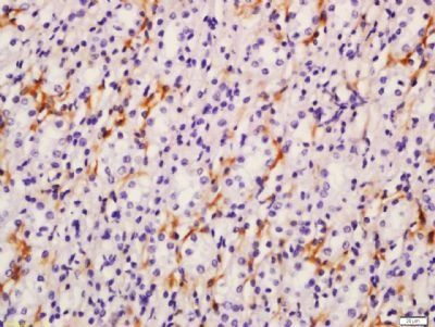 ADCY3 Rabbit Polyclonal Antibody