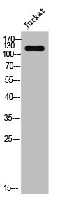 ADCY4 Antibody
