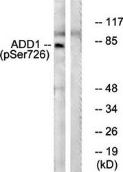 ADD1 (Phospho-Ser726) Antibody