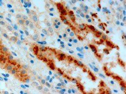 Goat anti-Adenosine A2b Receptor Antibody