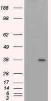 AK1 Antibody