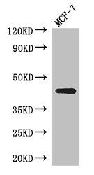 ADIPOR1 Antibody