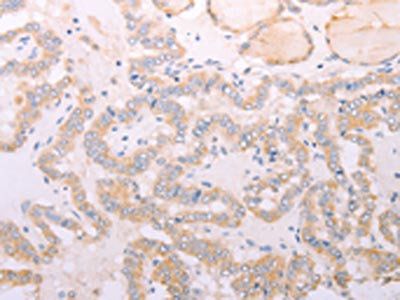 ADIPOR1 Antibody