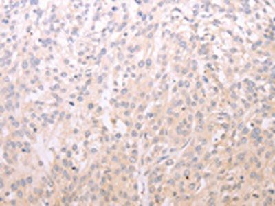 ADIPOR1 Antibody