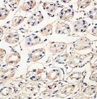 ADM2 Rabbit Polyclonal Antibody