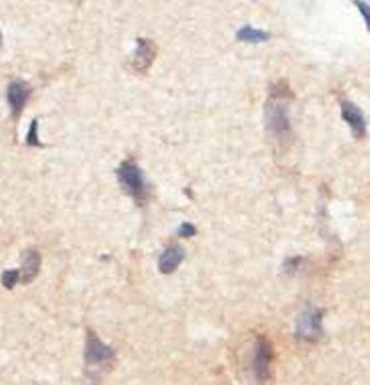 ADO Rabbit Polyclonal Antibody