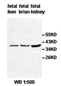 ADORA2B Rabbit Polyclonal Antibody