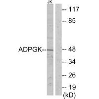 ADPGK Antibody