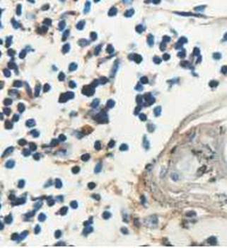 ADPRH Rabbit Polyclonal Antibody