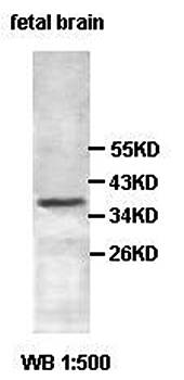 ADPRH Rabbit Polyclonal Antibody