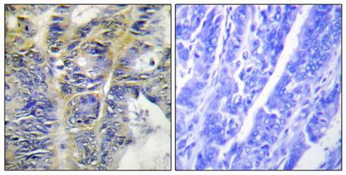 Collagen IV α5 Antibody