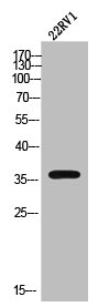 ADRB3 Antibody