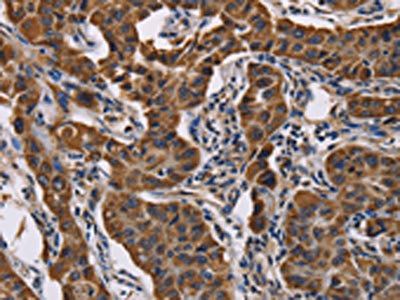 GRK3 Antibody