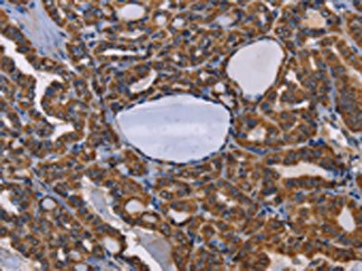 GRK3 Antibody