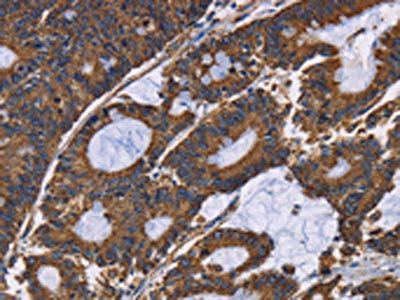 GRK3 Antibody