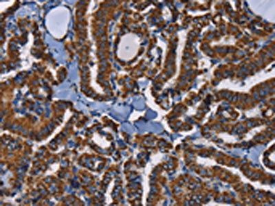 GRK3 Antibody
