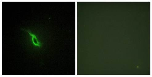 Adrenergic Receptor α-2A Antibody