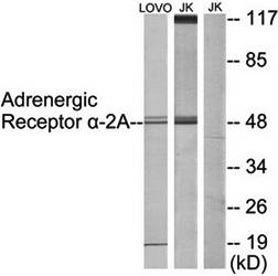 Adrenergic Receptor α-2A Antibody
