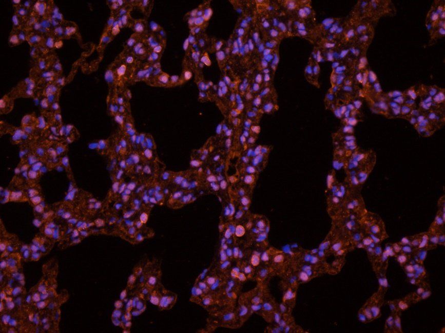 Adrenomedullin Rabbit Polyclonal Antibody