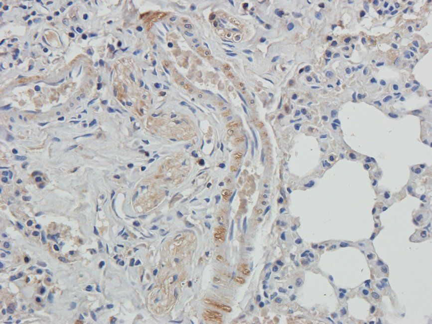 Adrenomedullin Rabbit Polyclonal Antibody