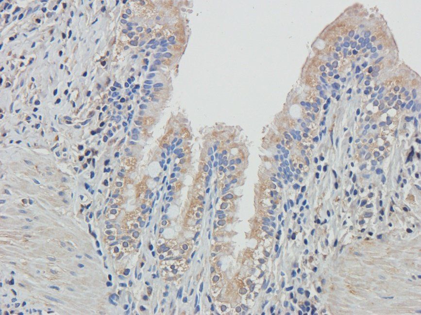 Adrenomedullin Rabbit Polyclonal Antibody