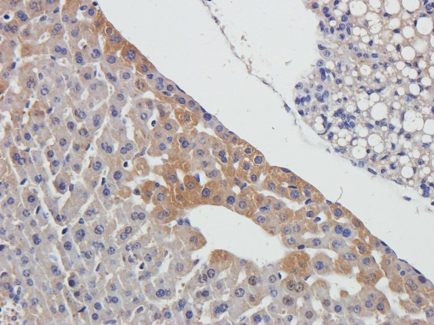 Adrenomedullin Rabbit Polyclonal Antibody