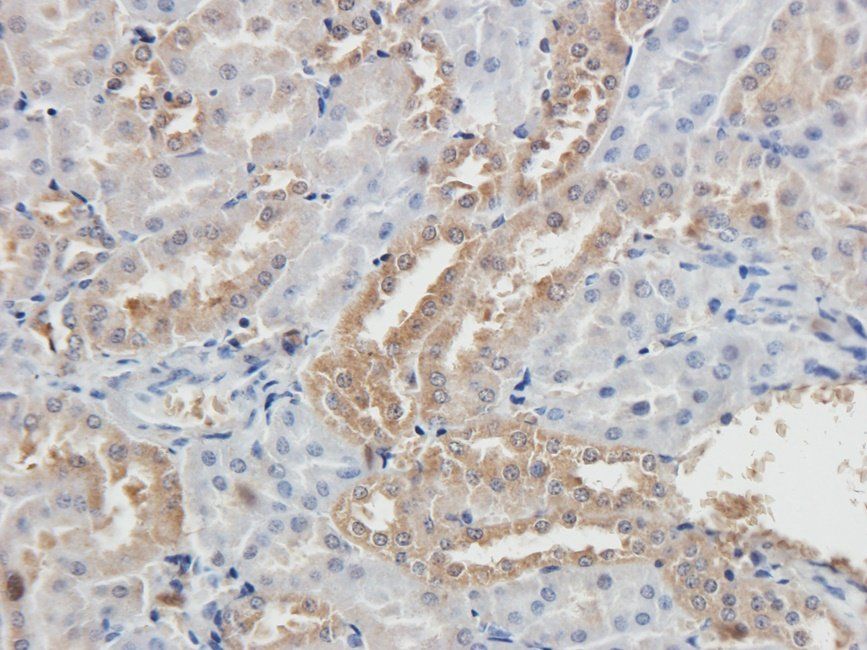 Adrenomedullin Rabbit Polyclonal Antibody