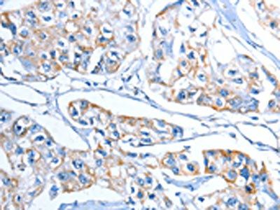ADSL Antibody
