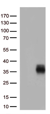 AEBP2 Antibody
