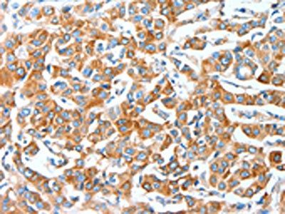 AFAP1 Antibody
