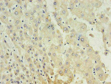 AFP Antibody