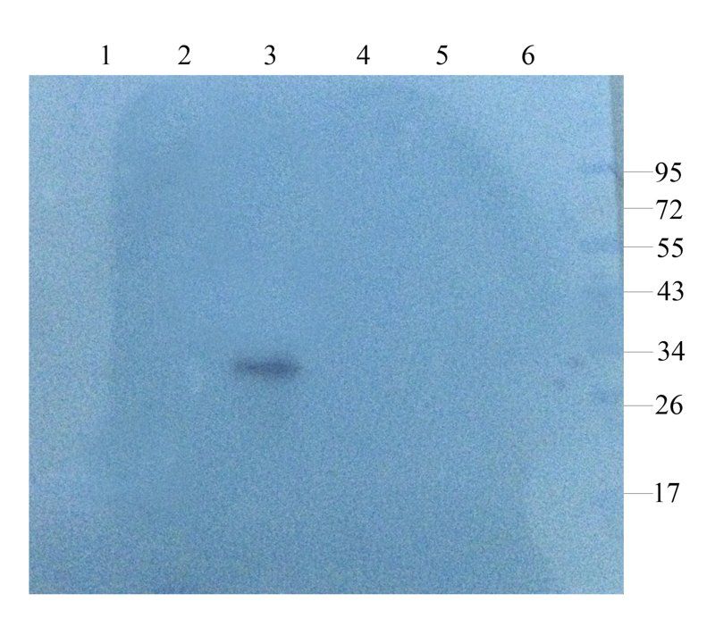 AFP Rabbit Polyclonal Antibody