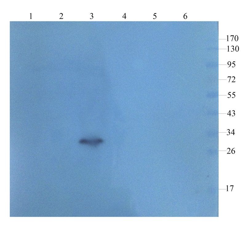 AFP Rabbit Polyclonal Antibody