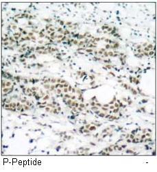 AFX (Phospho-Ser197) Antibody