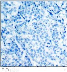 AFX (Phospho-Ser197) Antibody