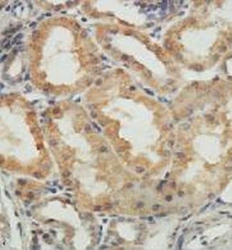 AGA Rabbit Polyclonal Antibody