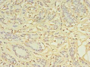 AGBL2 Antibody