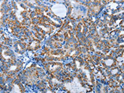 AGL Antibody