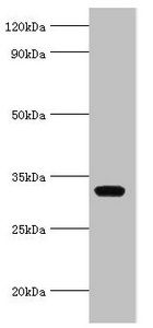 AGPAT1 Antibody