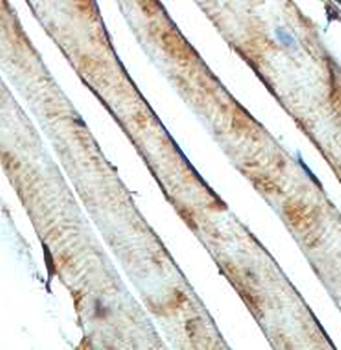 AGPAT1 Rabbit Polyclonal Antibody