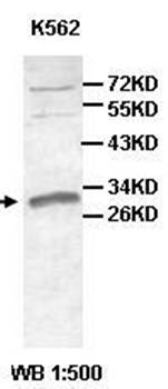 AGPAT1 Rabbit Polyclonal Antibody