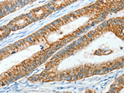 AGR3 Antibody