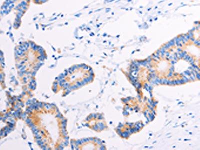 AGTR2 Antibody