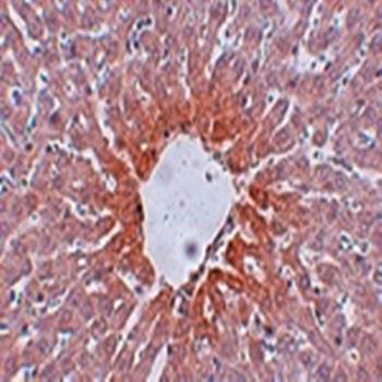 AGTR2 Rabbit Polyclonal Antibody