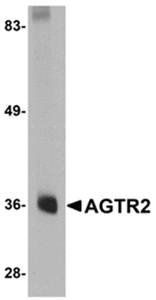 AGTR2 Rabbit Polyclonal Antibody